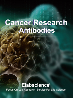 Cancer Research Antibodies