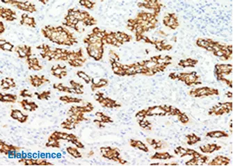 IHC on human kidney tissue using the ACE2 rabbit mAb
