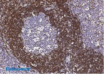 IHC on human tonsil tissue using the Bcl-2 rabbit mAb
