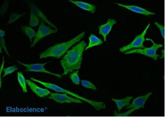 IF in HeLa cells using the Vimentin rabbit mAb