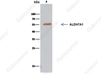 IP analysis using the ALDH7A1 rabbit mAb