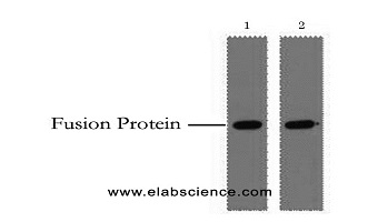 western blot analysis