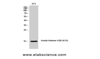 picture of E.coli