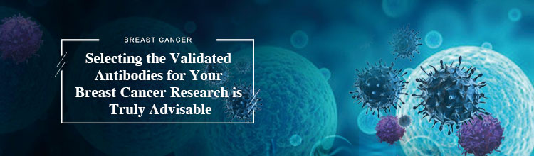 Breast_cancer Antibody