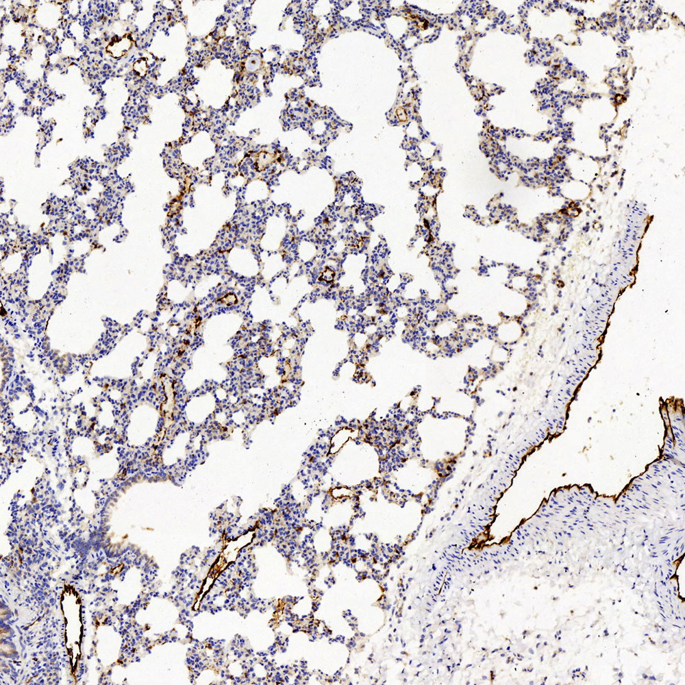 High Affinity And Specificity VWF Polyclonal Antibody E AB 70006 At