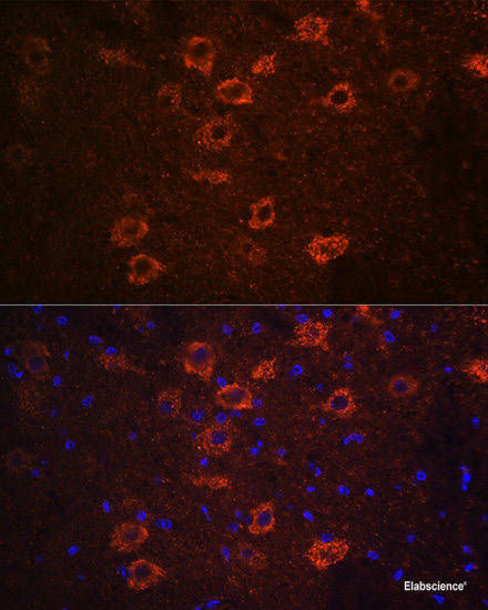 High Affinity And Specificity Slc A Polyclonal Antibody E Ab At