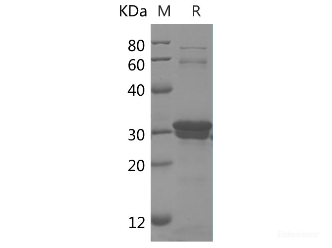 Recombinant Human DEFβ2/DEFB2 protein(GST tag)