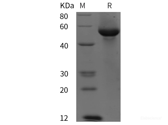 Quality Reliable Recombinant Human G6PD Protein His Tag PDEH100158 At