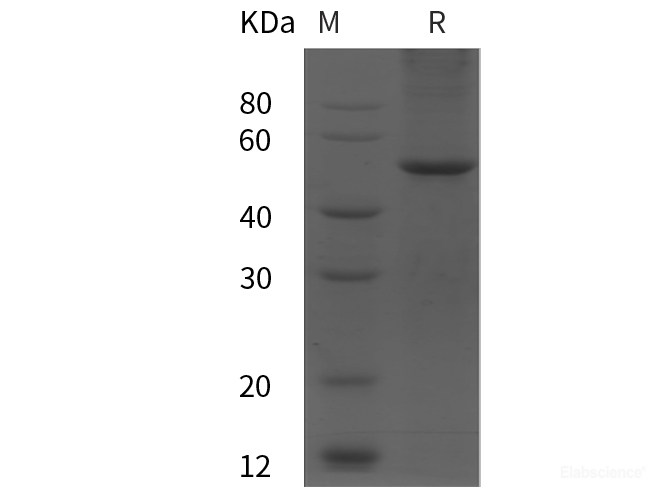 Recombinant Human KIM-1 protein (GST tag)