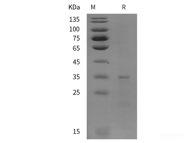 Recombinant Human IL-13 protein (SUMO,His tag)