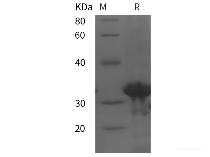 Recombinant Human FGF23 protein (SUMO,His tag)