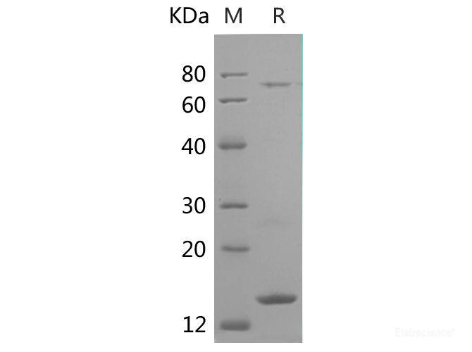 Recombinant Human Ub protein (His tag)
