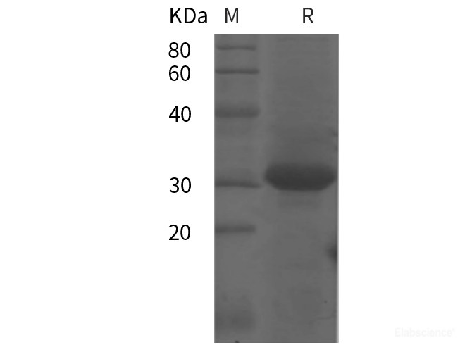 Recombinant Human PODXL protein (SUMO,His tag)