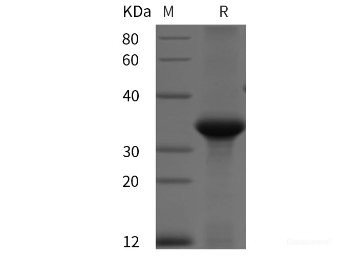Recombinant Human Cyclin D1 protein (His tag)