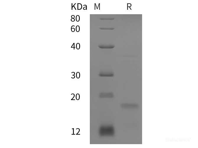 Recombinant Human P21 protein (His tag)