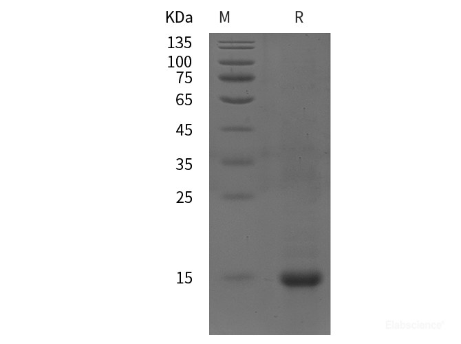 Recombinant Human SQSTM1/ p62 protein (His tag)