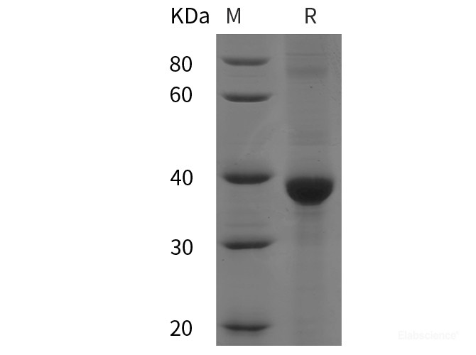 Recombinant Human BRCA1 protein (His tag)