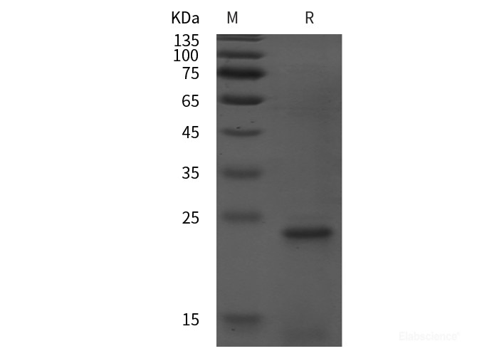 Recombinant Human GADD45A protein (His tag)