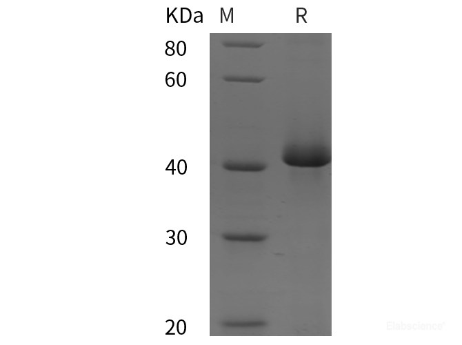 Quality Reliable Recombinant Human SIRPalpha SIRPA Protein His Tag