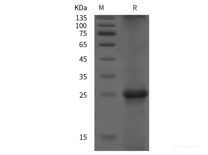 Recombinant Human Rac2 protein (His tag)