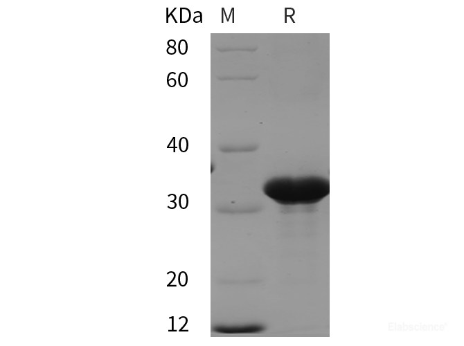 Recombinant Human RAB27A protein (His tag)