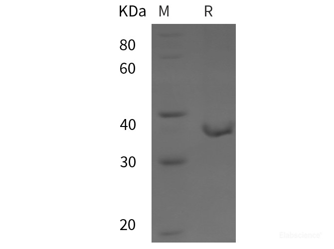 Recombinant Human MAP4K2 protein (His tag)