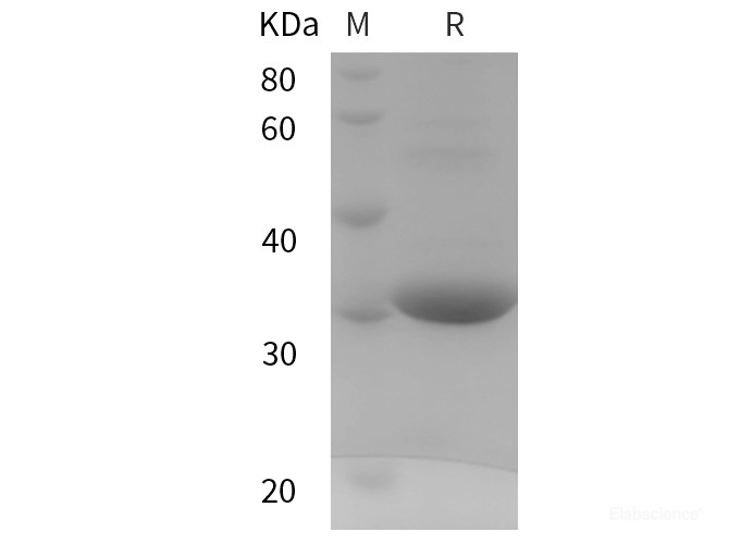 Recombinant Human UCP3 protein (SUMO,His tag)
