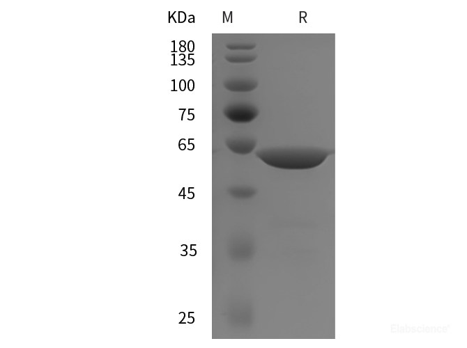 Recombinant Human ENO1 protein (GST tag)