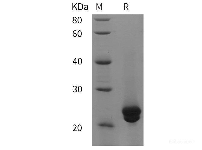 Recombinant Mouse NFATc1 protein (His tag)