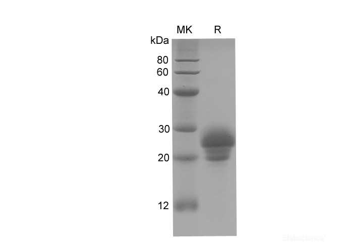 Recombinant Rat OC/BGP protein(His&SUMO tag)