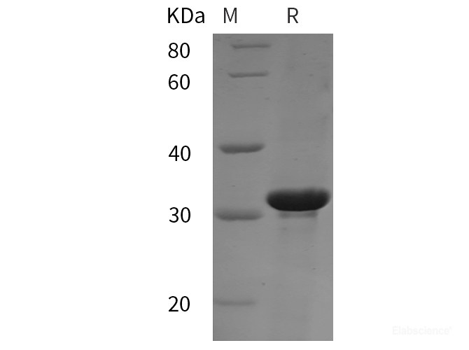 Recombinant Rat RB1 protein (His tag)