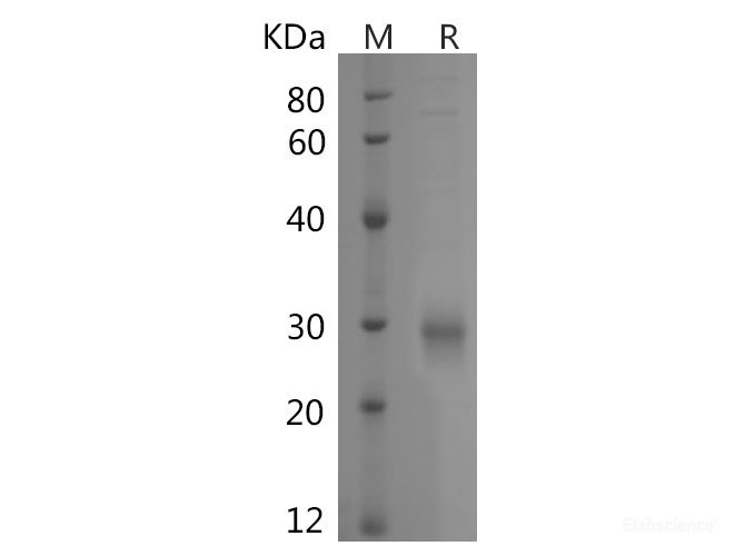Recombinant Human TNFSF4/OX40L protein (His tag)