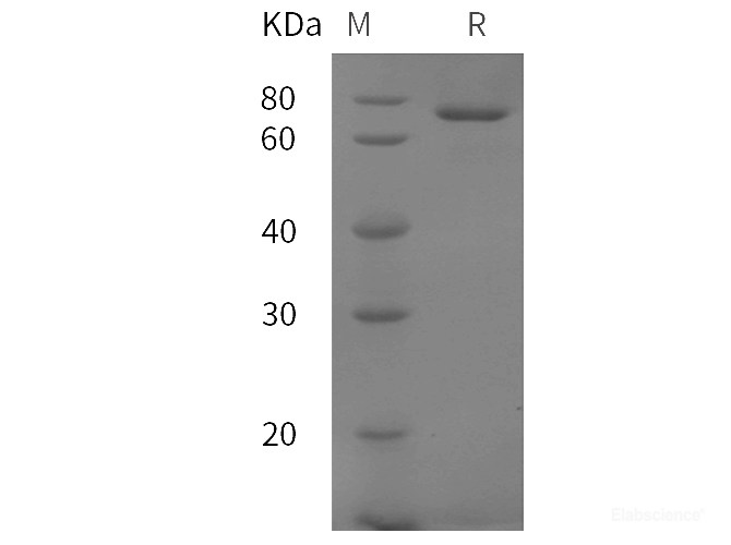 Recombinant Mouse Transferrin/TF protein (His tag)