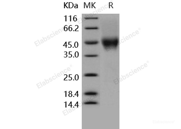 Recombinant Human CD16a / FCGR3A Protein (176 Val, His & AVI tag)-Elabscience