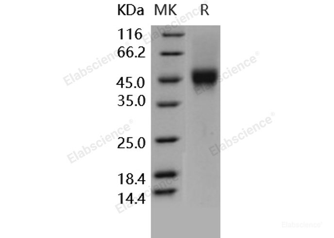 Recombinant Human CD16a / FCGR3A Protein (176 Phe, His & AVI tag)-Elabscience