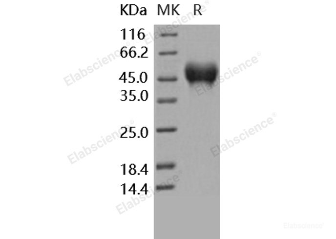 Recombinant Human CD16a / FCGR3A Protein (176 Phe, His tag)-Elabscience