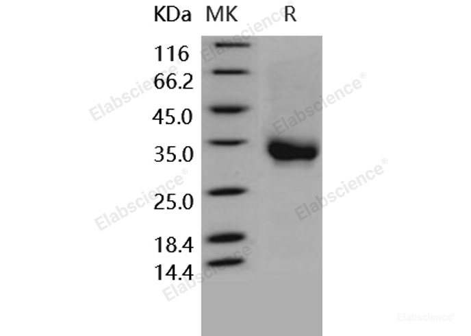 Recombinant Human CD32a / FCGR2A Protein (167 His, His & AVI tag), Biotinylated-Elabscience