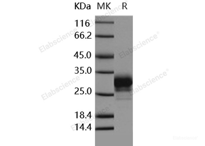 Recombinant Human CD32a / FCGR2A Protein (167 His, His tag)-Elabscience