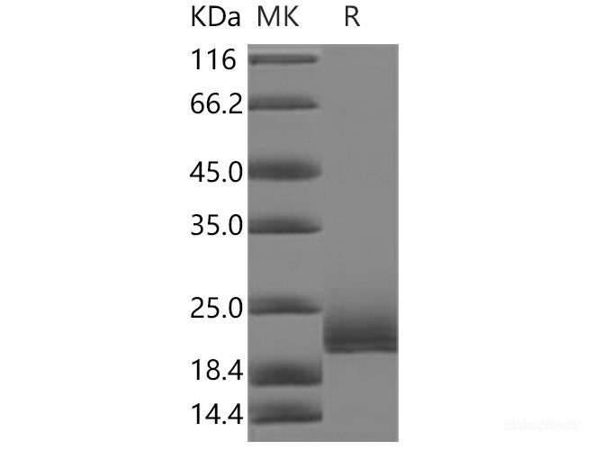 Recombinant Human CD16b / FCGR3B Protein,  Biotinylated-Elabscience