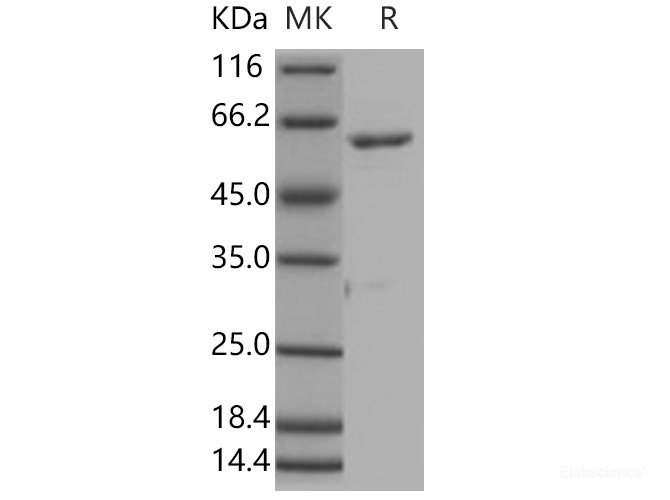 Recombinant Human ROR1 Protein (aa 453-783, His & GST tag)-Elabscience
