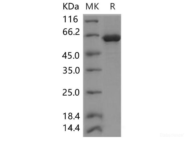Recombinant Human EphA2 Protein (aa 585-976, His & GST Tag)-Elabscience