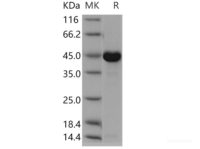 Recombinant Human CKMT1A Protein (His tag)-Elabscience