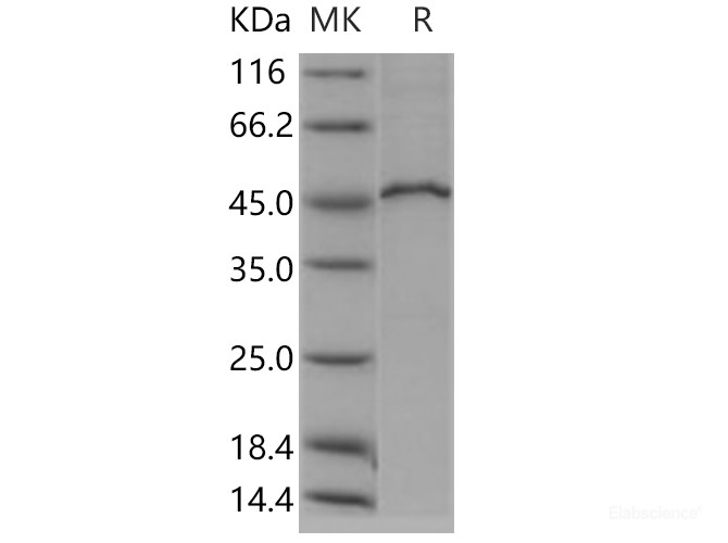 Recombinant Human MVK / Mevalonate kinase Protein (His & GST tag)-Elabscience