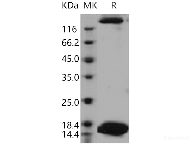 Recombinant Human SPEG / APEG-1 Protein (His tag)-Elabscience
