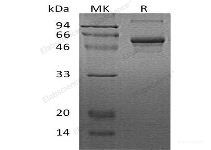 Recombinant Human Casein Kinase 1 gamma 2 Protein (His Tag)-Elabscience