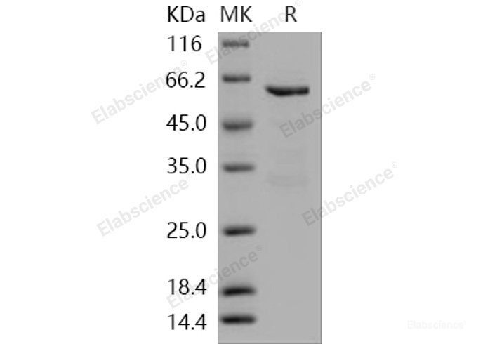 Recombinant Human MUSK Kinase Protein (aa 433-783, His & GST tag)-Elabscience