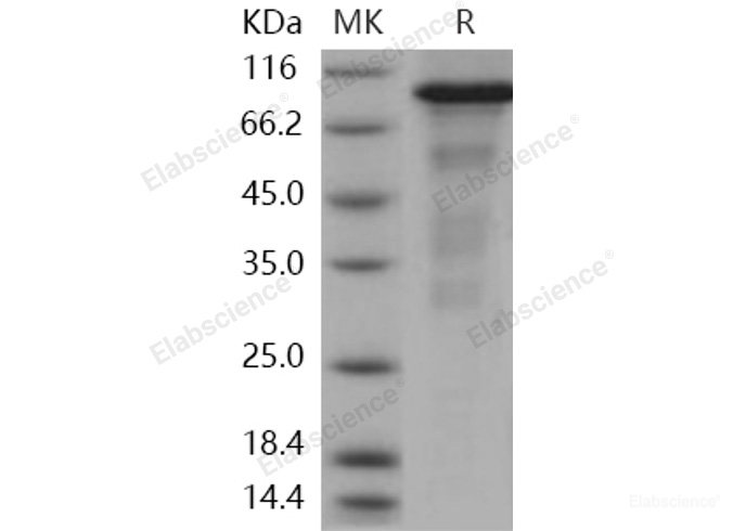 Recombinant Human ERN1 / IRE1 Protein (aa 465-977, His & GST tag)-Elabscience