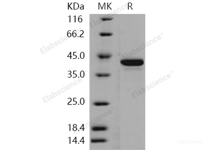 Recombinant Human STK10 / LOK Protein (His tag)-Elabscience