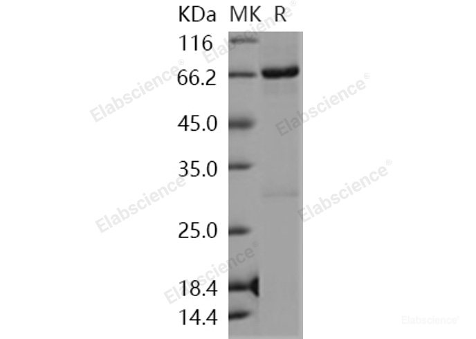 Recombinant Human nemo-like kinase / NLK Protein (His & GST tag)-Elabscience