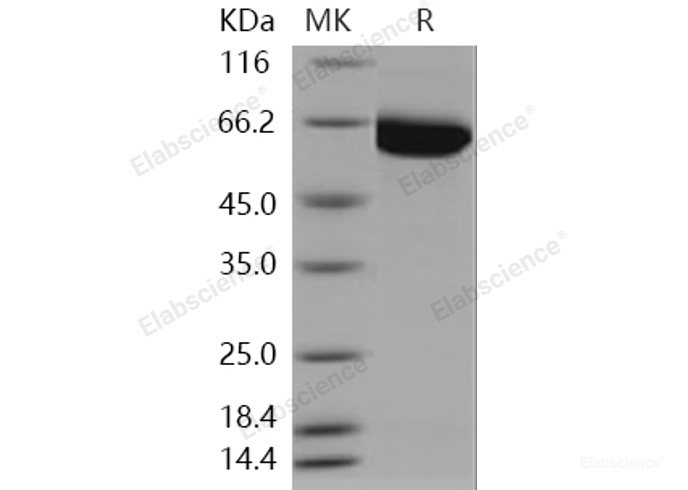 Recombinant Human PAK3 Protein (His tag)-Elabscience